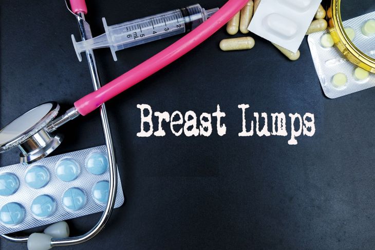Frequently Asked Questions About Breast Lumps