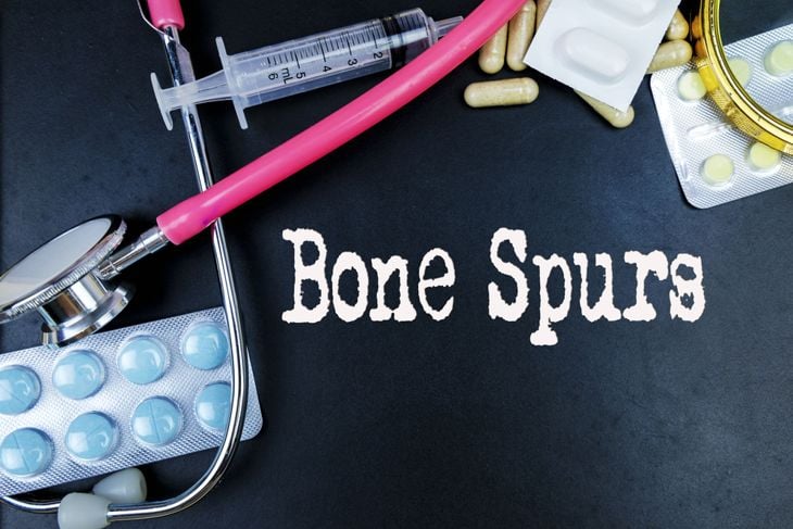 What are Bone Spurs?
