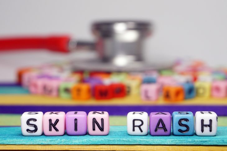 What is a Viral Rash?