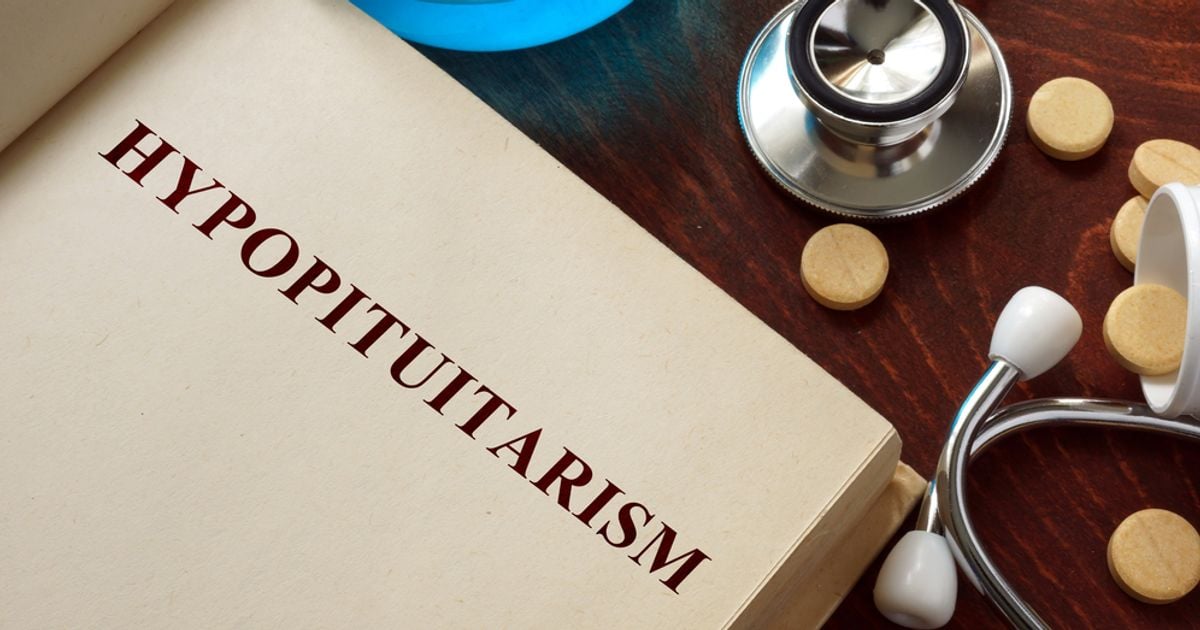 10 Facts About Hypopituitarism Facty Health