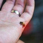 10 Facts About Bee Allergies
