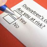 10 effective ways to manage Dupuytren's Contracture