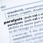 10 Frequently Asked Questions About Facial Paralysis