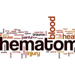 10 Things You Need to Know About Perianal Hematomas