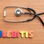 10 Facts About Phlebitis