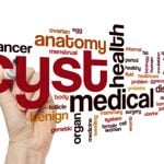What Is Pilonidal Sinus