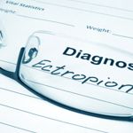 10 Facts About Ectropion