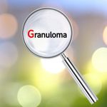 Understanding Granulomatous Inflammation: Causes and Symptoms