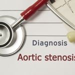 10 Key Facts about Aortic Stenosis