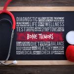 Frequently Asked Questions About Benign Bone Tumors