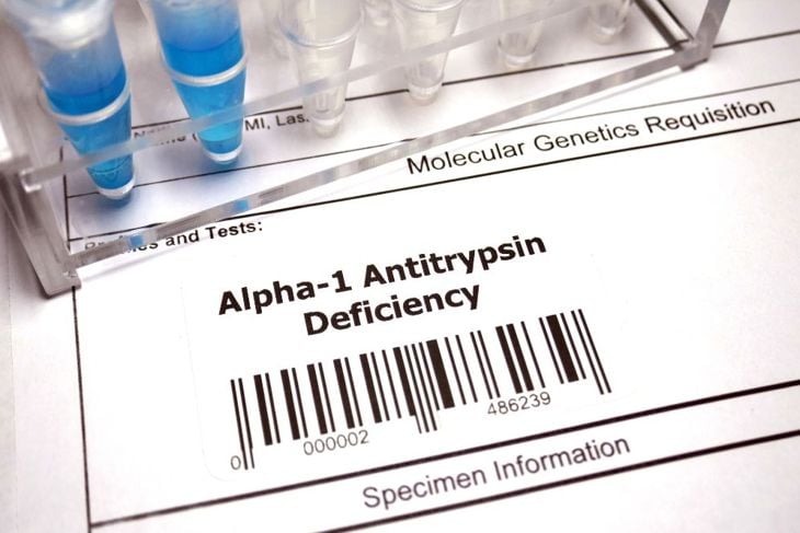 Effects of Alpha-1 Antitrypsin Deficiency (A1AD)