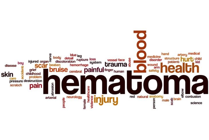 10 Things You Need to Know About Perianal Hematomas