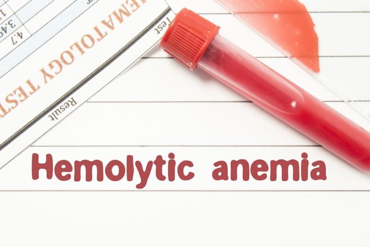 10 Frequently Asked Questions About Hemolysis