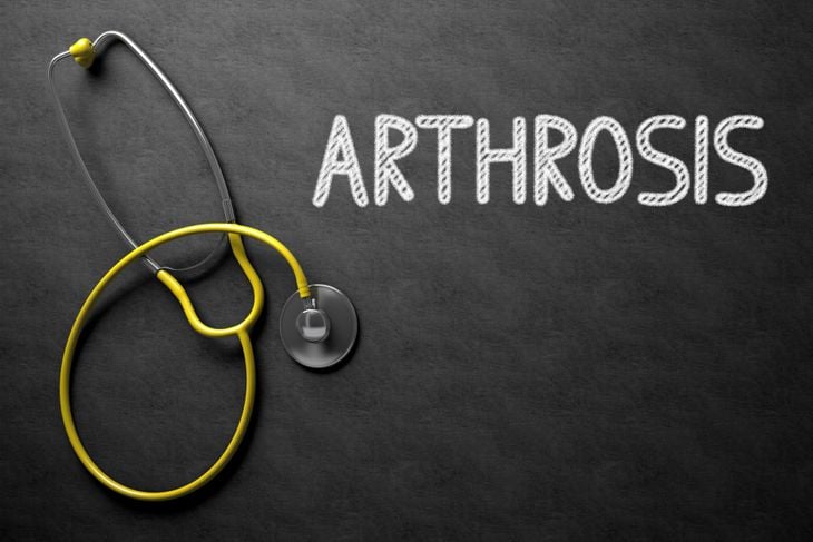 10 Lifestyle Changes for Managing Arthrosis Symptoms
