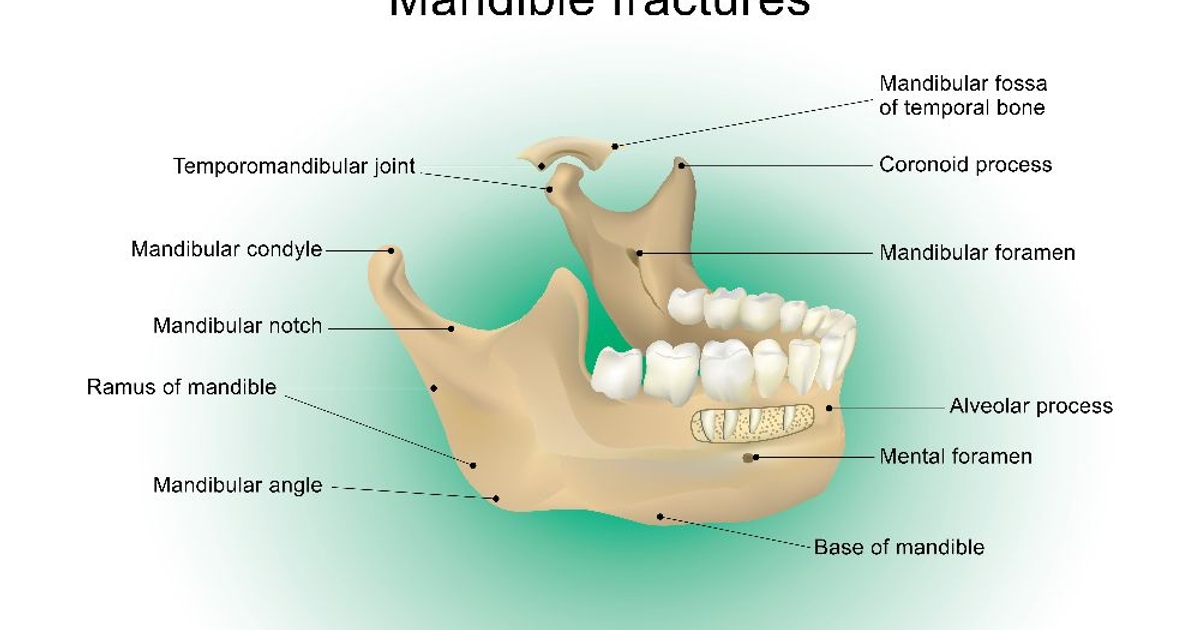 10 Important Facts About a Fractured Jaw Facty Health