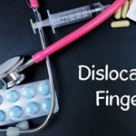 All About Finger Dislocation