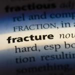Common Types of Fractures