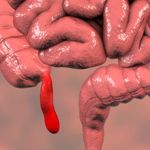 Understanding the Appendix and Its Associated Conditions
