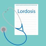 What is Lordosis?