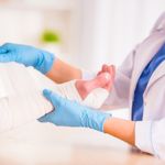 Causes, Symptoms, and Treatments of a Scaphoid Fracture