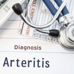 What is Takayasu's Arteritis?
