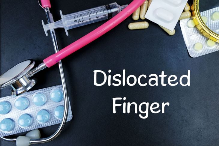 All About Finger Dislocation