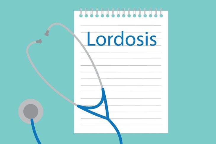 What is Lordosis?