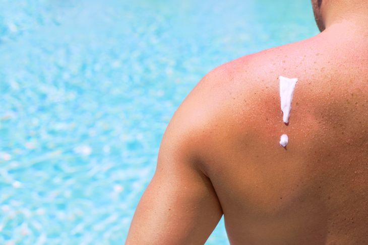Recognizing and Treating a Sun Allergy