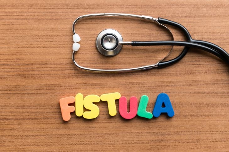 10 Facts About Fistulas