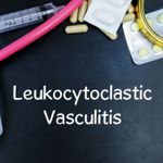 Symptoms and Risks of Leukocytoclastic Vasculitis