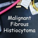 What are Malignant Fibrous Histiocytomas?