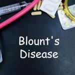 Causes and Treatments of Blount's Disease