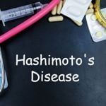 Hashimoto’s Disease: When Your Immune System Slows You Down