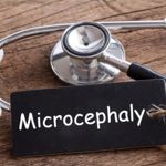 What is Microcephaly?