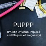 Facts About PUPPP Rash