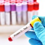 Functions of Protein in the Human Body