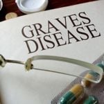 12 Common Symptoms of Graves Disease