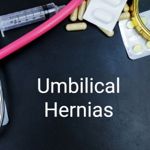 Facts About Umbilical Hernias