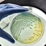 E. coli Causes and Treatments