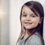 Interesting Facts About Birthmarks