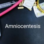 What is Amniocentesis?