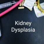 What is Kidney Dysplasia?