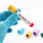 All About Lithium Poisoning and Toxicity