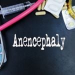 Everything You Need to Know About Anencephaly