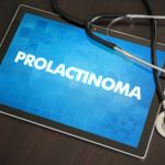 Treatments for Prolactinoma