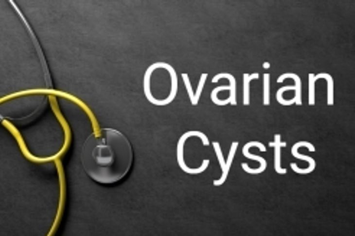 10 Symptoms and Treatments of Ovarian Cysts