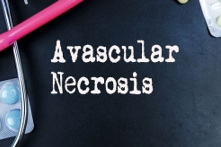 Understanding Avascular Necrosis: Causes and Risk Factors