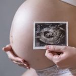 The Stages of Pregnancy