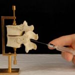What are Epidurals?