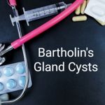 Understanding Bartholin's Gland Cysts